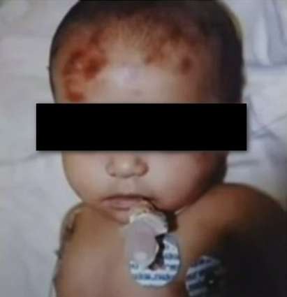 2-годишният Йордан, пребит от мащехата си, е в кома