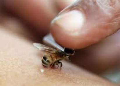 55-годишен мъж почина след ужилване от пчела в Карнобат