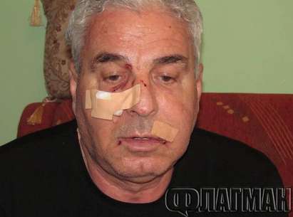 Светкавична акция на бургаската полиция: Задържаха 16-годишния батка, пребил мъж в кв. Сарафово