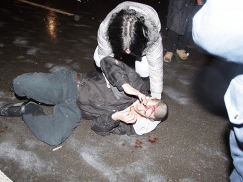 Кърваво меле пред дискотека! Гимнастик прати в спешното 26-годишен с тежки травми на главата