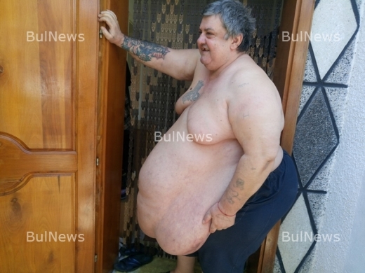 Това е най-дебелият мъж в България: Гриша от Лиляче тежи над четвърт тон!