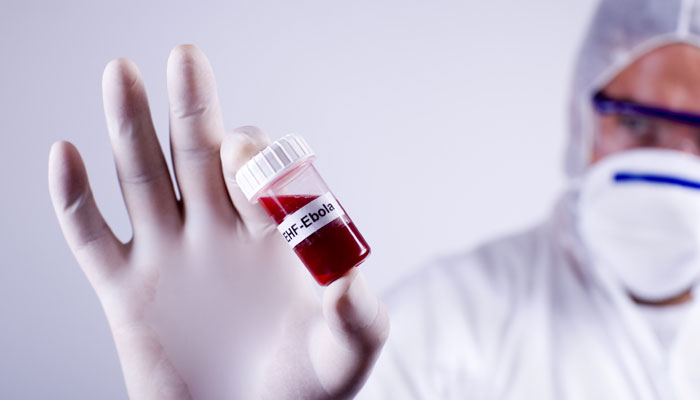 В шведска болница лекуват пациент със симптоми на ебола