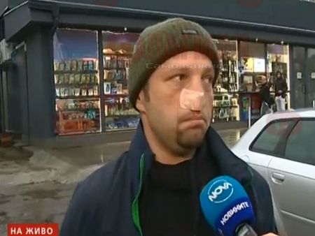 Потресаващо! Мъж отхапа носа на шофьор в София, изцапа му и колата с яйца