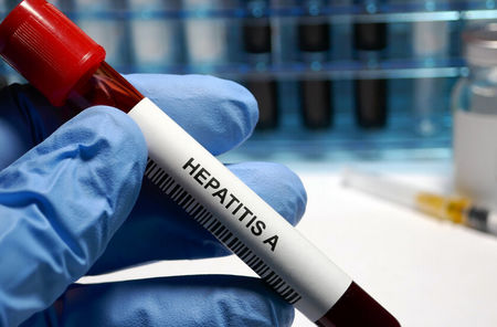 Внимание! Рязко нарастват заболелите от вирусен хепатит А в Бургаско