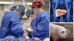 За първи път в света: Трансплантираха черен дроб от прасе на човек