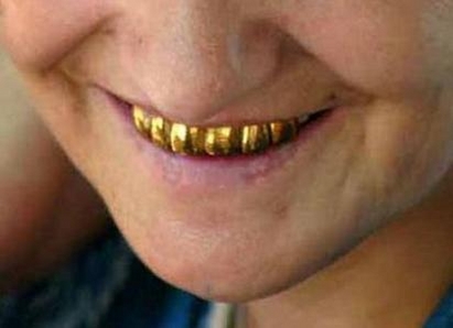Откраднаха зъбите на 50-годишен помориец