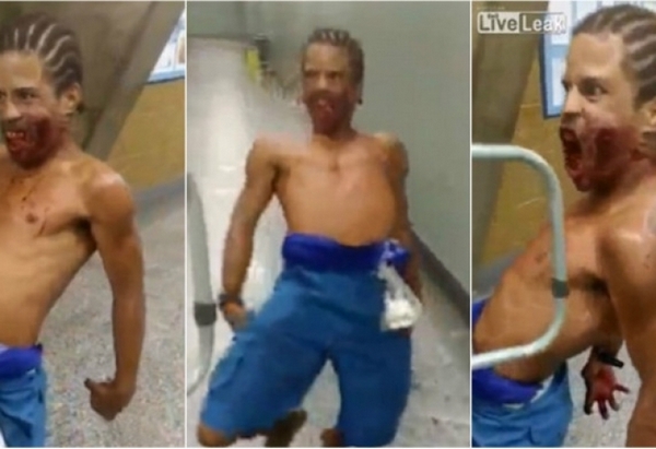 Мъж с дупка в лицето хвърли болница в паника (ВИДЕО +18)